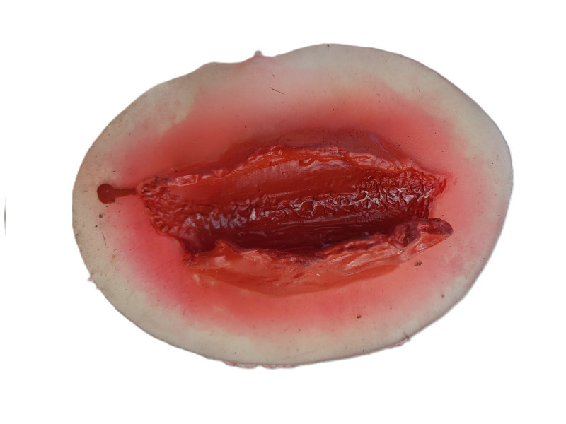 Wunde-Gross-7